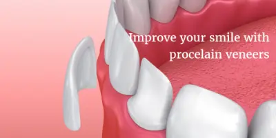 Fairfax Porcelain Veneers Dentist - Dr. Pamela Marzban